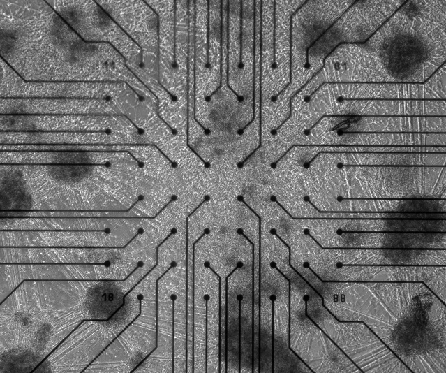 Black-and-white micrograph of cultured neural tissue on a multi-electrode array with circuit traces