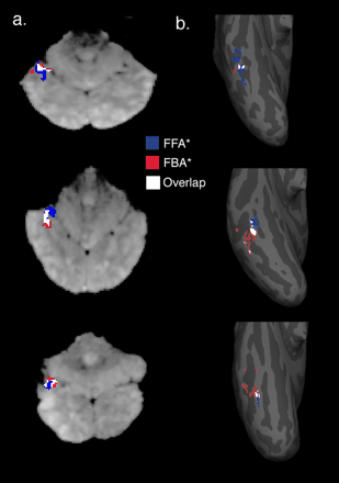 Schwarzlose et al. 2005 Figure 1 — high-resolution FFA* (blue) and FBA* (red) regions of interest in three participants, shown on ventral surface of the right hemisphere