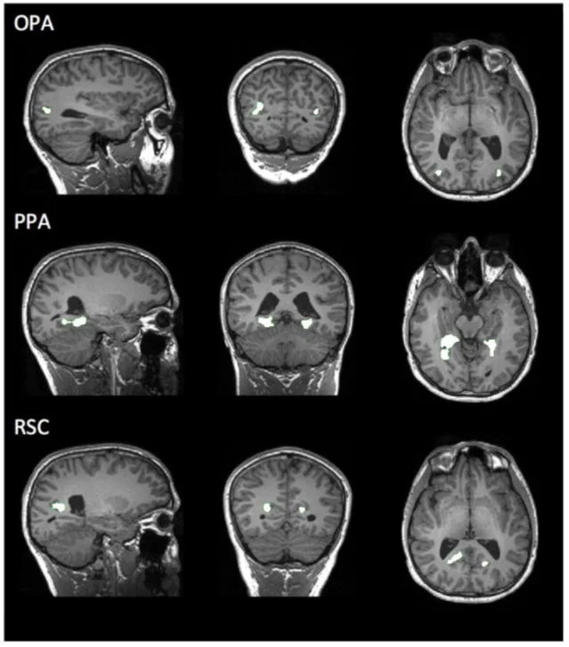 OPA, PPA, and RSC shown on MRI slices in a single representative participant, each highlighted in green on sagittal, coronal, and axial views