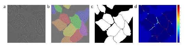 U-Net 原论文 Figure 3:原始显微图、实例标注、二值分割与像素级损失权重