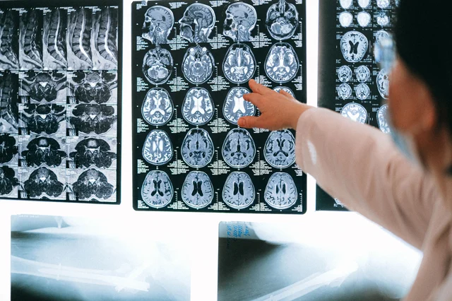 Radiologist reviewing MRI scan images of the human body on a medical workstation