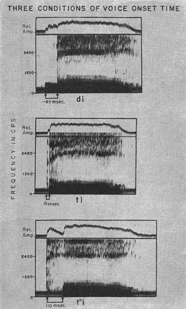 Three voice onset time conditions