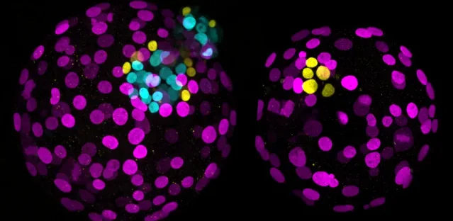 Two fluorescent day-6 human embryo images comparing control and NANOG knockout conditions