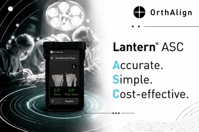 OrthAlign Lantern ASC handheld orthopedic navigation system for ambulatory surgery centers