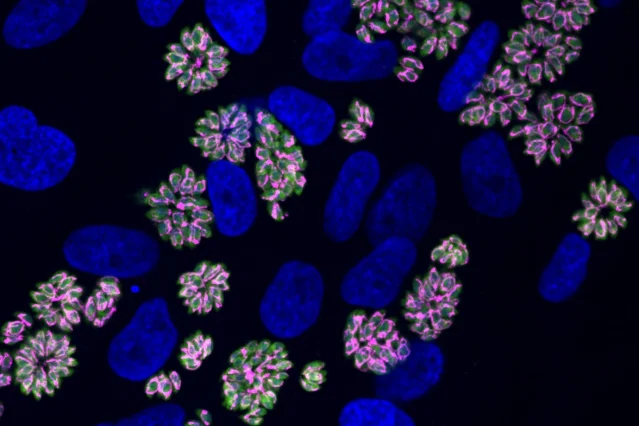 Fluorescence microscopy image showing green Toxoplasma parasites among blue nuclei