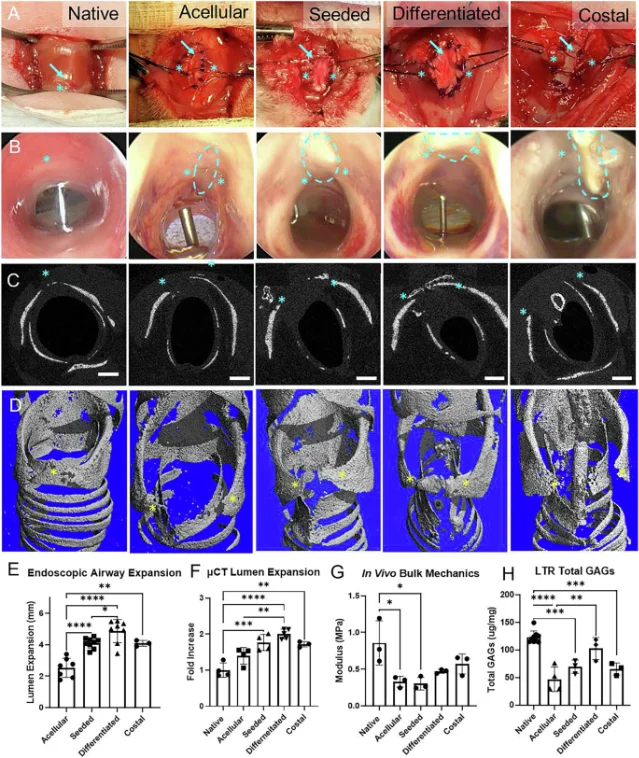 Rabbit laryngotracheal reconstruction outcomes at 3 months: MEND grafts vs autologous costal cartilage comparisons including airway expansion, re-epithelialization, and histology (Gehret, Gottardi et al., Fig. 6)