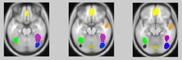 Colored functional parcels from watershed segmentation of the faces>objects overlap map