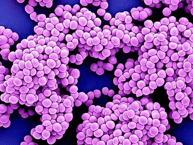 MRSA bacteria — antibiotic-resistant Staphylococcus aureus under scanning electron microscope