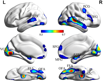 Functional connectivity map of the face network showing face-selective regions (OFA, FFA, STS, amygdala, frontal regions) and within-network versus between-network connectivity patterns across participants