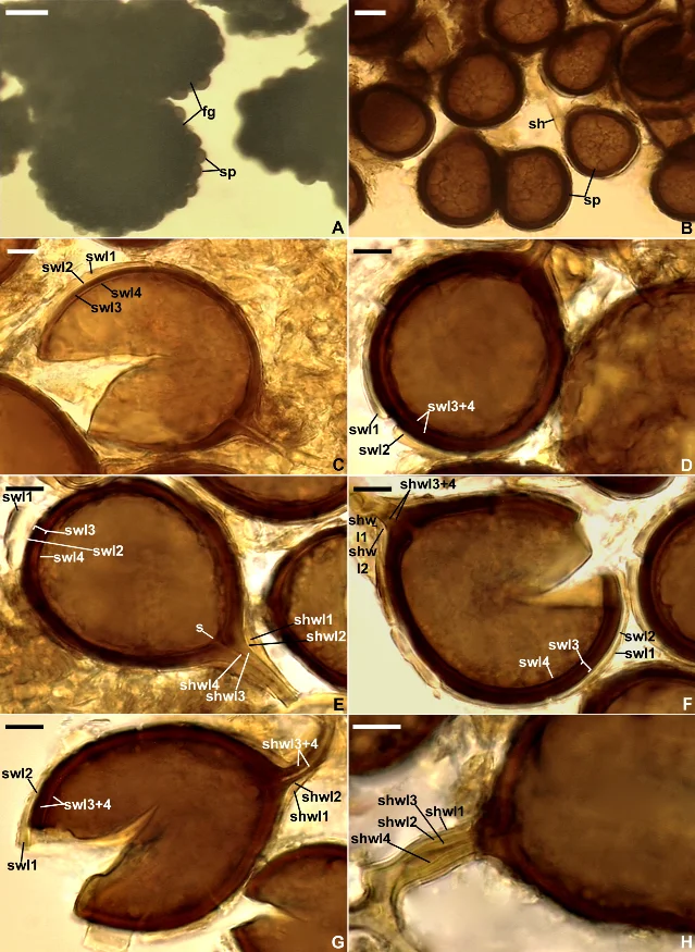 Durabilispora carpatica and Dominikia tatrensis spore morphology — composite microscope image showing spore wall layers, peridium, and radial spore arrangement on amber-toned background