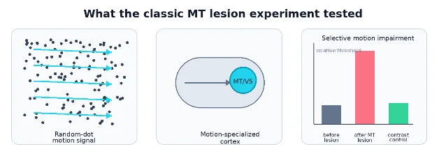Schematic of random-dot motion signal, MT/V5 location, and threshold change after lesion