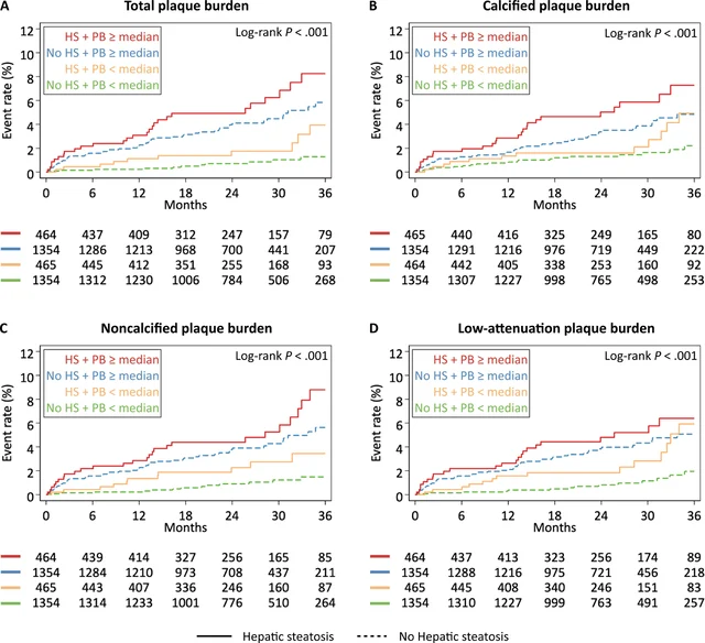 Kaplan-Meier event curves showing cumulative MACE rates over 36 months, stratified by hepatic steatosis (HS) presence and plaque burden (PB) level — patients with both HS and high plaque burden (red line) had the highest event rate