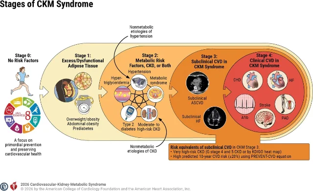 CKM Syndrome staging infographic showing progression from Stage 0 (no risk factors, primordial prevention) through Stages 1-4 — each stage adding layers of metabolic risk, subclinical CVD, and finally clinical cardiovascular disease including CHD, heart failure, stroke, AFib, and PAD