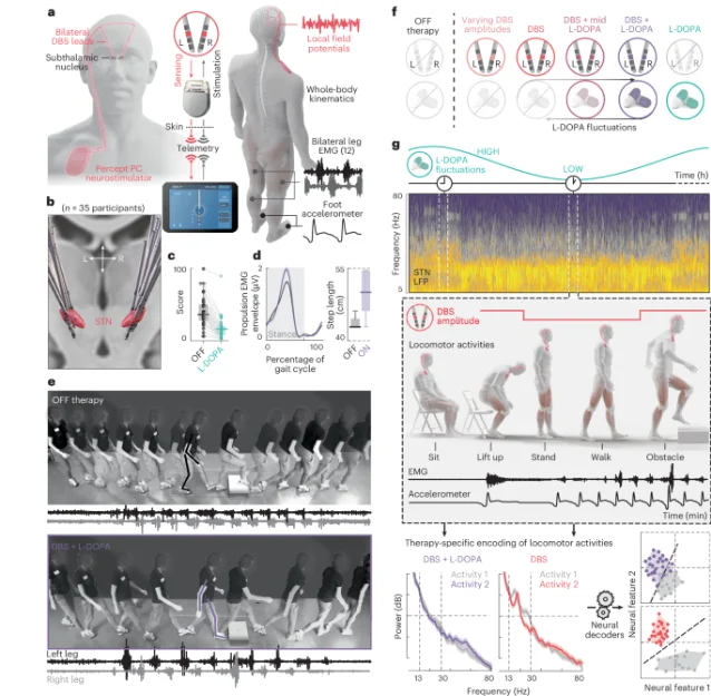 Experimental setup for activity-dependent STN DBS: Medtronic Percept PC recording bilateral STN LFP across locomotor contexts (Scafa et al., Fig. 1)