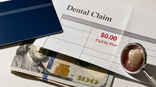 The hidden billing traps in your dental and vision plan